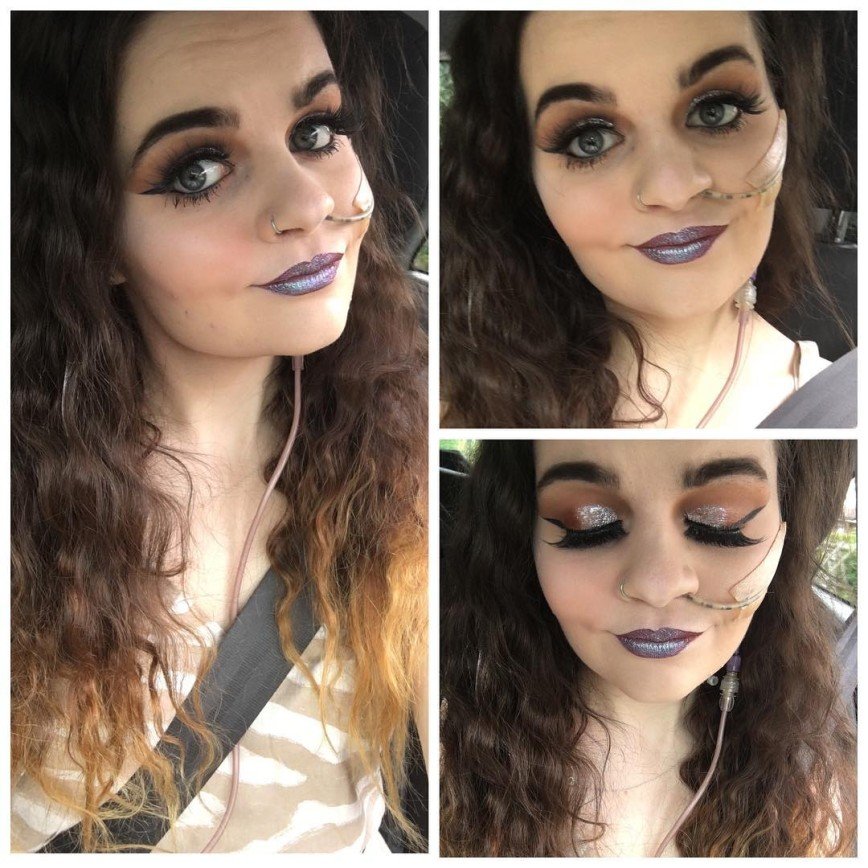22-летняя девушка делает яркий макияж, чтобы отвлечь внимание от трубки на лице