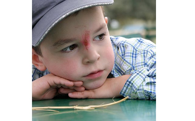 Типичные симптомы сотрясения мозга у детей