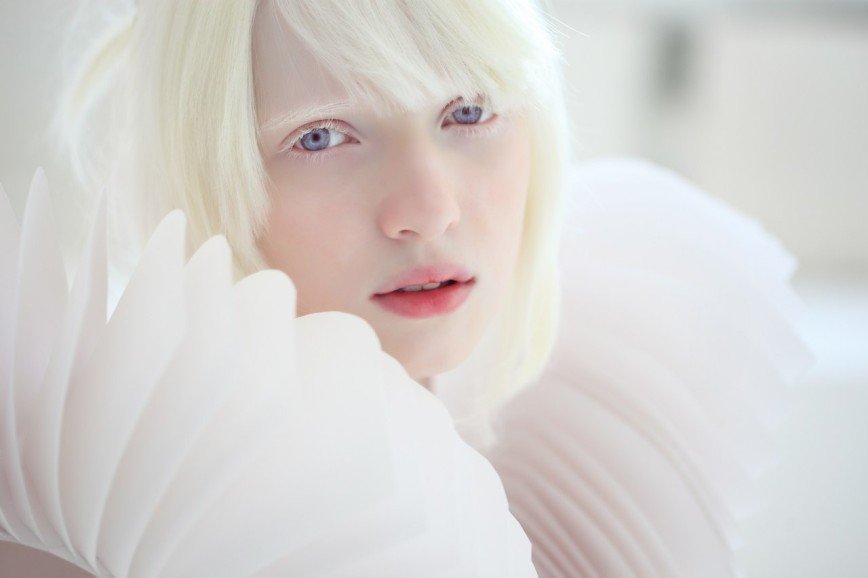 В Африке прошел первый в мире конкурс красоты для альбиносов