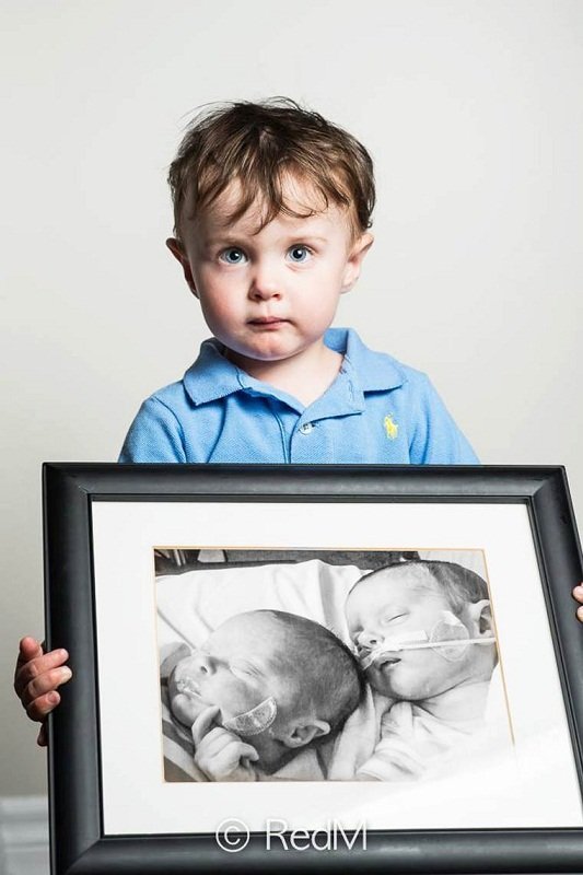 Сквозь годы: трогательные фото детей, родившихся недоношенными: [i]Ной, родился в 32 недели. Его сестра-близнец Виктория, слева на фотографии в рамке, скончалась после одного месяца жизни[/i]