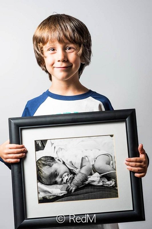 Сквозь годы: трогательные фото детей, родившихся недоношенными: [i]Сэмюэль, родился в 36 недель[/i]