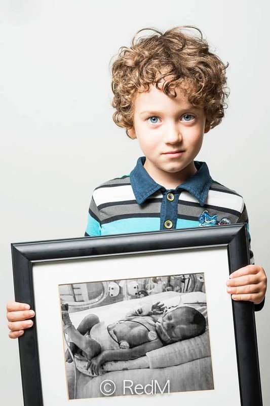 Сквозь годы: трогательные фото детей, родившихся недоношенными: [i]Томас, родился в 29 недель[/i]