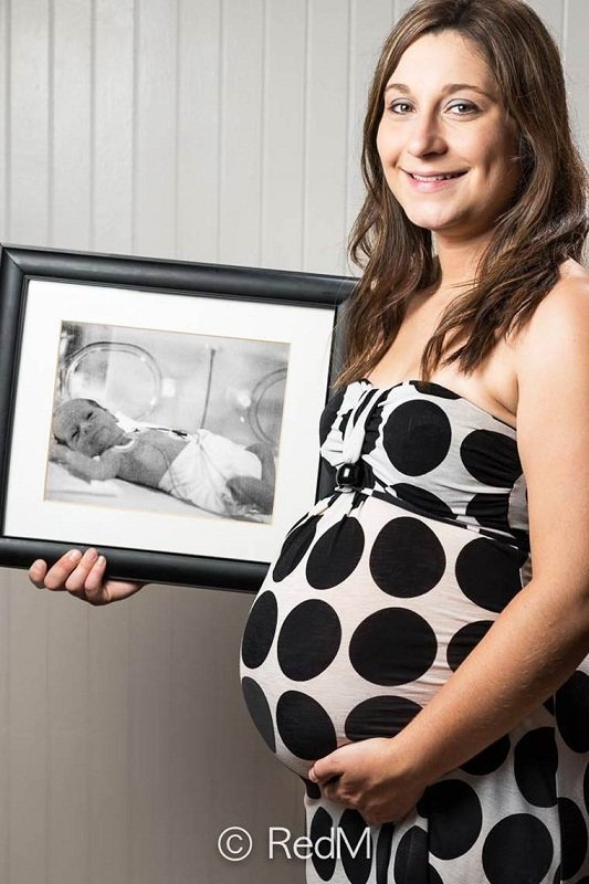 Сквозь годы: трогательные фото детей, родившихся недоношенными: [i]Андреанн, родилась в 32 недели[/i]