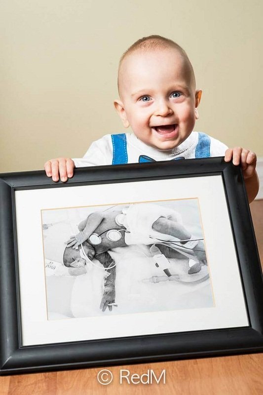 Сквозь годы: трогательные фото детей, родившихся недоношенными: [i]Эмиль, родился в 26 недель[/i]