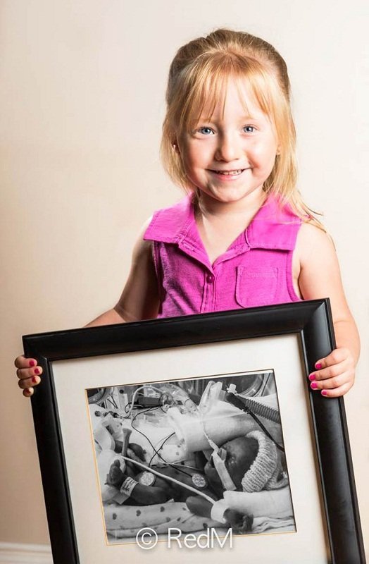 Сквозь годы: трогательные фото детей, родившихся недоношенными: [i]Джульетта, родилась в 30 недель[/i]