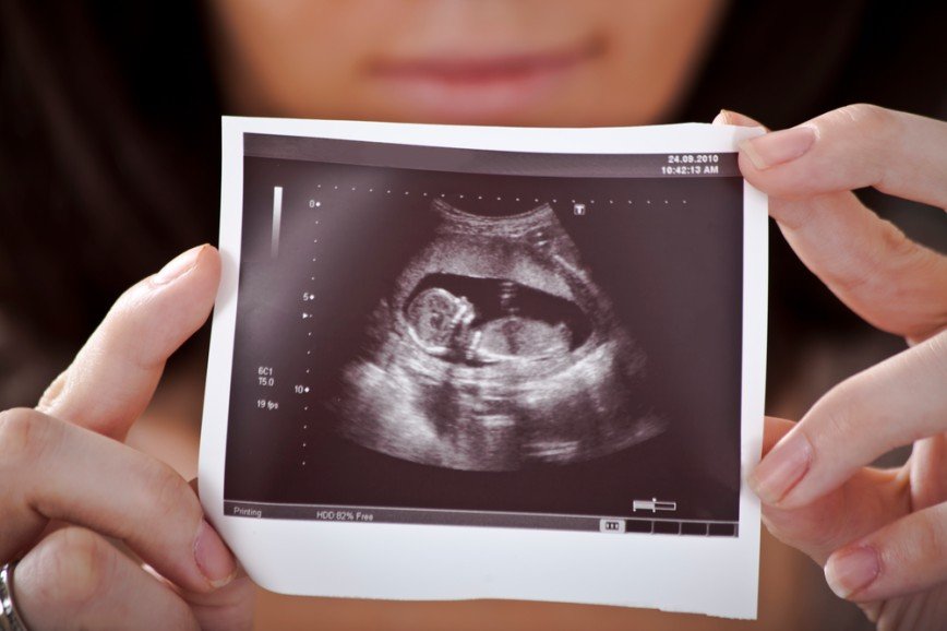 Тест на беременность: как и когда делать?