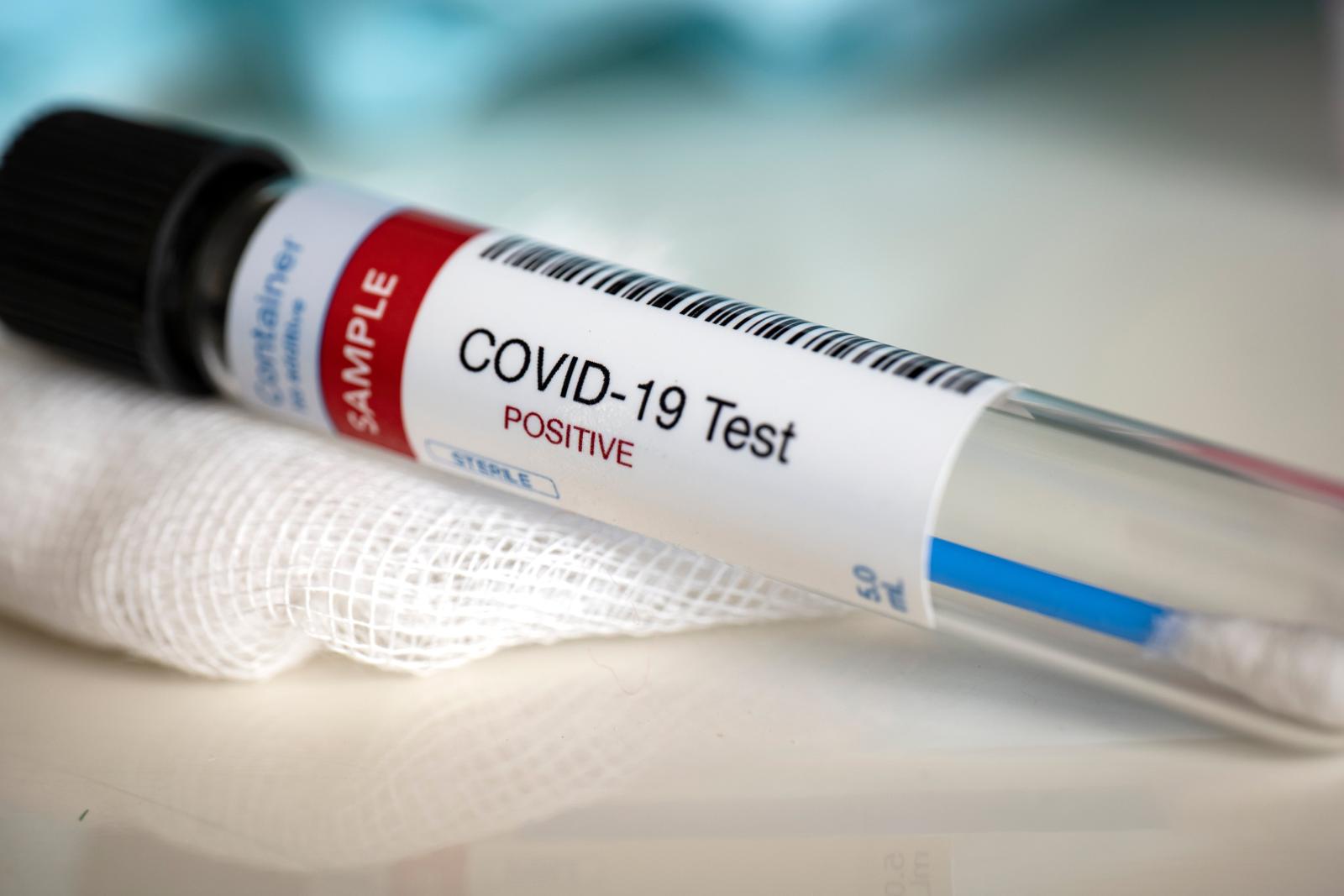 Положено ли лечение от коронавируса бесплатно? И другие виды бесплатной медицинской помощи, о которых вы должны знать