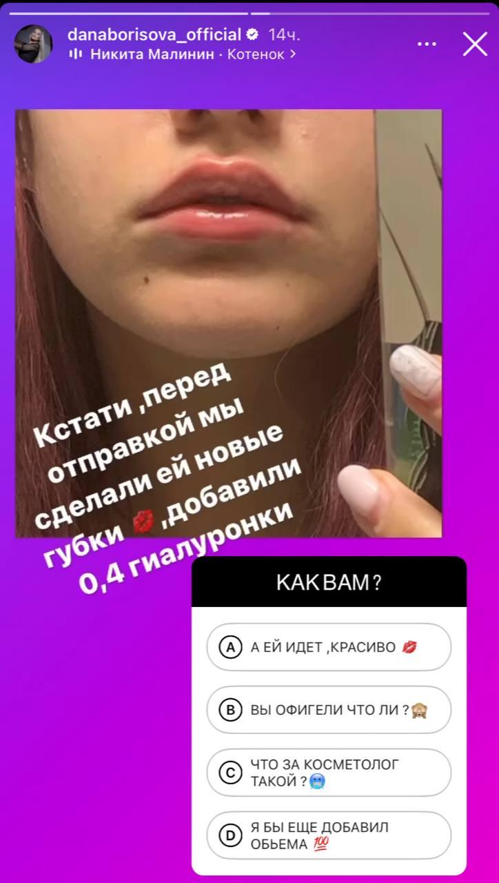 Дана Борисова позволяет дочери-подростку делать уколы красоты 