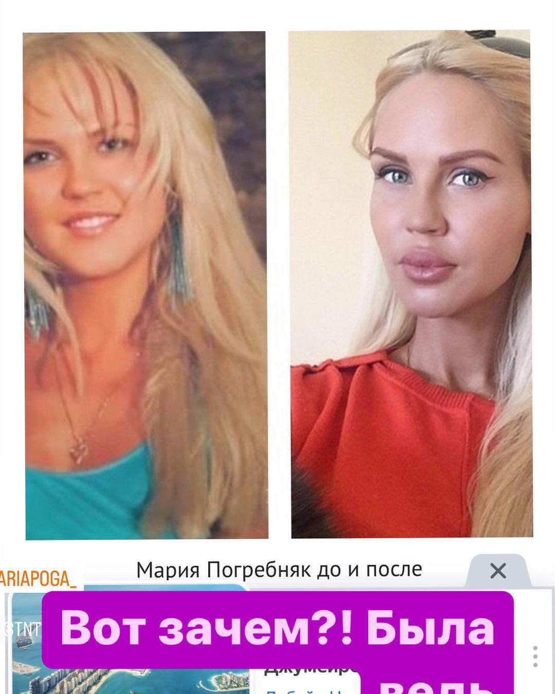 Мария Погребняк до и после пластических операций / соцсети